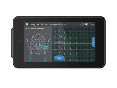 PCECG-500 12 elvezetéses mini EKG